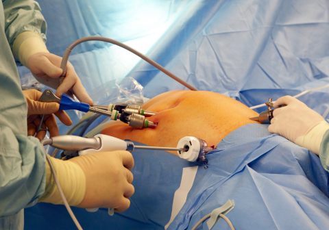 Laparoscopic Liver and Bile Duct Surgery